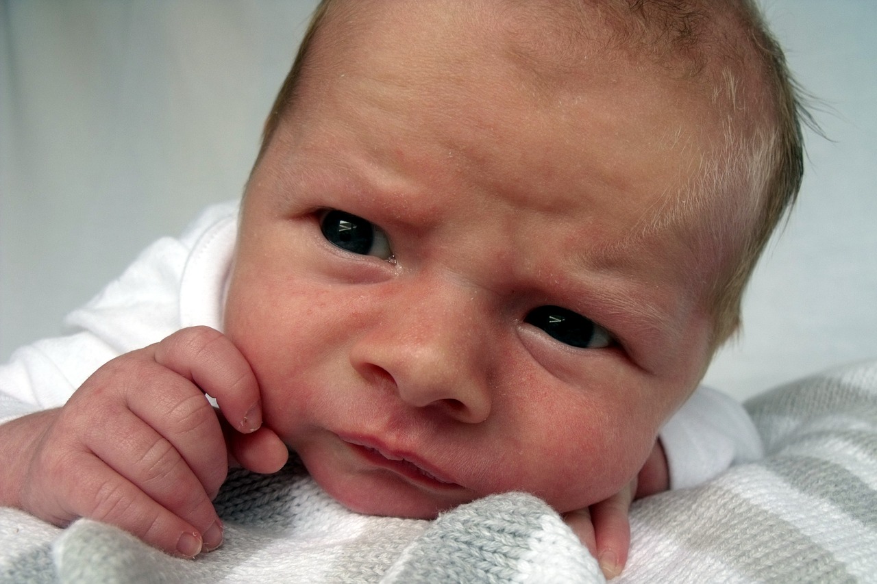赤ちゃんの顔の毛細血管が浮き出ている原因は？対処法や注意点